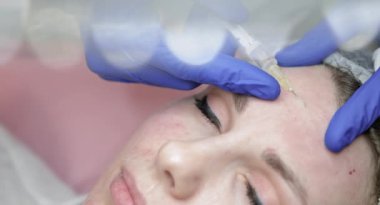 Güzellik kliniğinde mezoterapi ve yüz gerdirme. Güzellik uzmanı ve kadın yüzüne yakın çekim. Kozmetik uzmanı kadın derisine çoklu biyoevrim enjeksiyonu yapıyor..