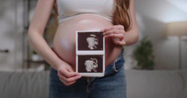 Hamile bir kadın iki ultrason görüntüsü taşıyor. Fetüs yüzleri gelişiyor, annelik ve yeni bir hayat bekliyor. Ultrason Fotoğrafları Tutan Hamile Kadın