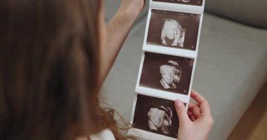 Kadının elinde üç ultrason görüntüsü var. Fetüs yüzü ve kafası profil görüntüsünde gelişiyor. Beklenti ve neşe anı yakalıyor. Ultrason Fotoğrafları Tutan Kadın