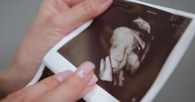 Kadınların el ele tutuşup bebek suratının 3 boyutlu ultrason görüntüsünü göstererek beklenti ve neşe gösteriyorlar. Ultrason Fotoğrafı Tutan Kadın