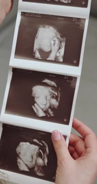 Elinde üç boyutlu ultrason görüntüsü olan kadın detaylı yüz hatları ve elleri olan bir fetüs geliştirdiğini gösteriyor.