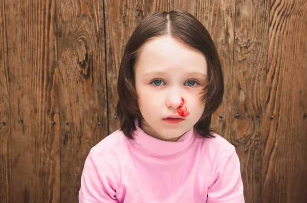 Çocuk burun kanaması vardır