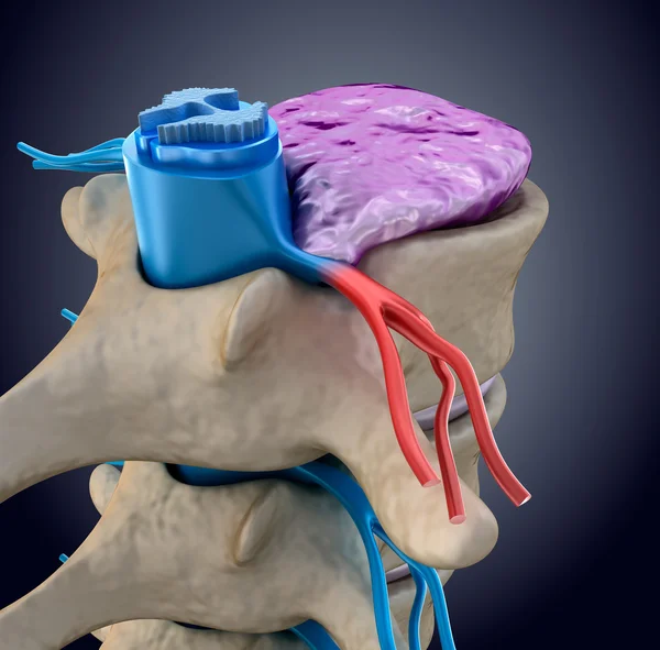 Spinal cord under pressure of bulging disc — Stock Photo © Alexmit
