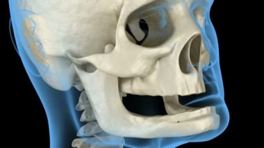 Alt çene, dişlerini kaybettikten sonra kemik durgunluğu. Tıbben doğru 3 boyutlu diş canlandırması