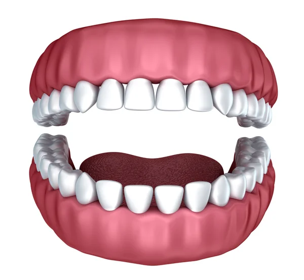 치과 임 플 란 트 흰색 절연 — 스톡 사진