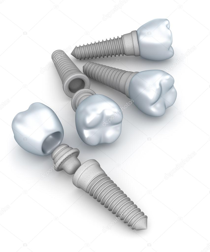 Dental implants, crowns and pins isolated on white