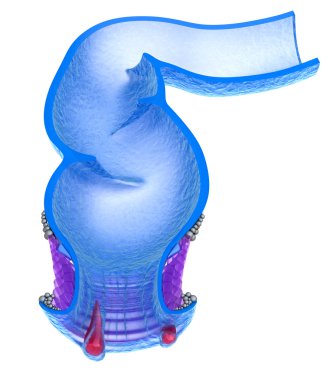 Hemorrhoids : Anal disorders, xray view clipart