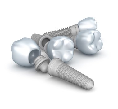 Dental implants, crowns and pins isolated on white clipart