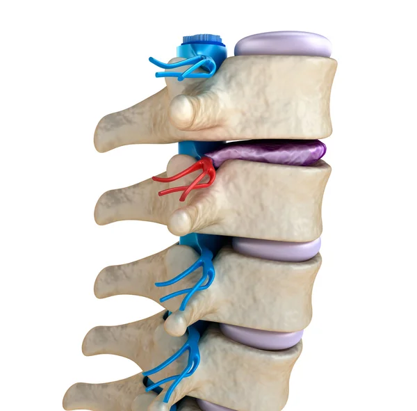Spinal cord under pressure of bulging disc — Stock Photo, Image