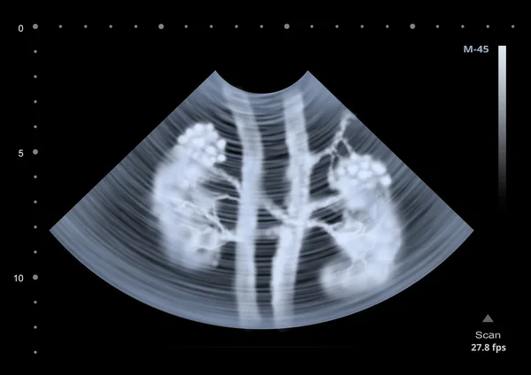 腎の超音波スキャン。図 — ストック写真