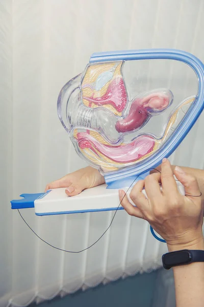 Anatomik numune. Kadının üreme sisteminin yerleşim planına göre. Bir kadının genikolojik organları. Doktor elinde bir organ örneği tutuyor..