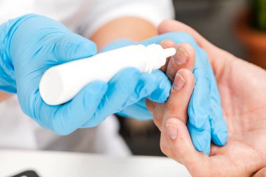 Bir dermatolog hasta bir hastayı tedavi etmek için damla kullanır. Deri hastalıklarının incelenmesi ve teşhisi alerji, sedef, egzama, deri iltihabı..