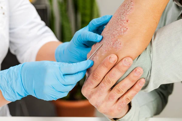 Bir dermatolog hasta bir hastanın deri analizini yapar. Deri hastalıklarının incelenmesi ve teşhisi alerji, sedef, egzama, deri iltihabı.