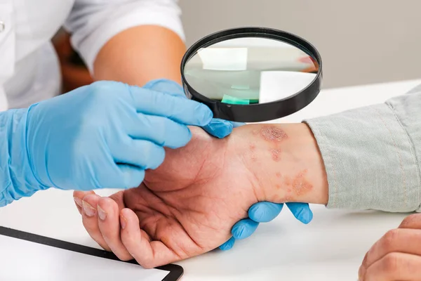 Eldiven takan bir dermatolog hasta bir hastanın derisini inceliyor. Deri hastalıklarının incelenmesi ve teşhisi alerji, sedef, egzama, deri iltihabı..