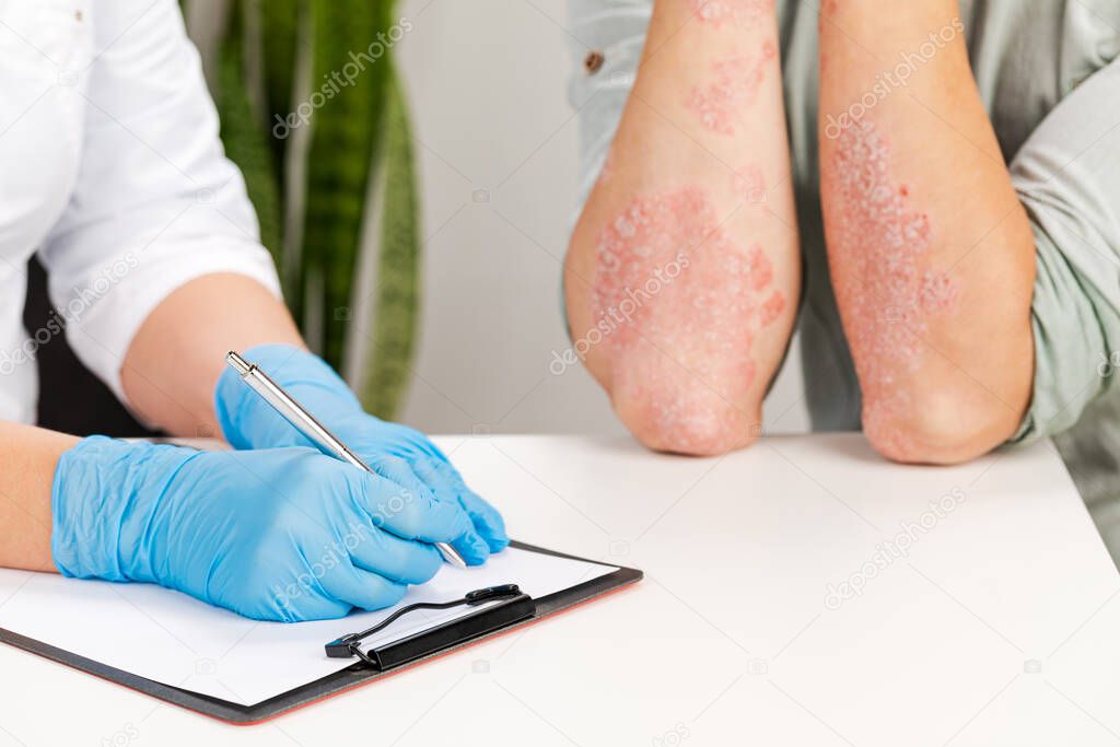 A gloved dermatologist examines the skin of a sick patient and records observations. Examination and diagnosis of skin diseases-allergies, psoriasis, eczema, dermatitis.