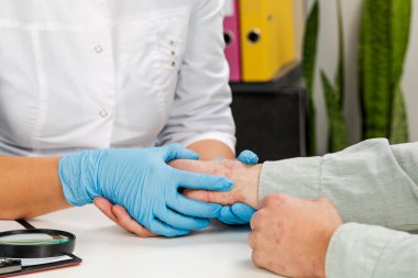 Eldiven takan bir dermatolog hasta bir hastanın derisini inceliyor. Deri hastalıklarının incelenmesi ve teşhisi alerji, sedef, egzama, deri iltihabı..