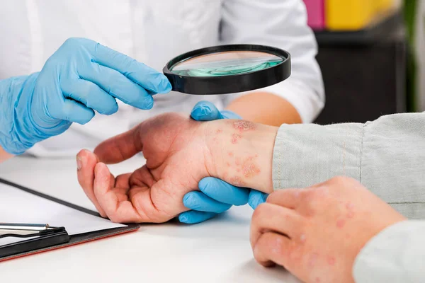 Dermatologue Portant Des Gants Examine Peau Patient Malade Examen Diagnostic — Photo
