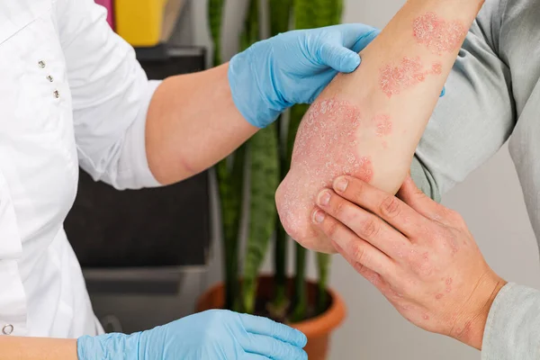 Dermatologo Che Indossa Guanti Esamina Pelle Paziente Malato Esame Diagnosi — Foto Stock