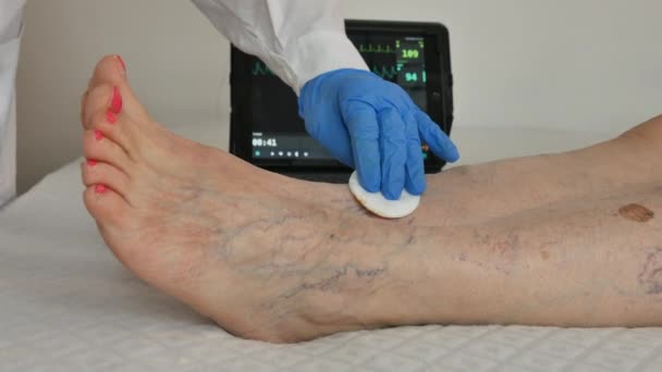 Пациентка у врача со шприцем, у которой проверены ноги варикозным расширением вен — стоковое видео