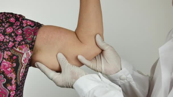 Chirurg care face un control medical prin palparea antebrațului, pe țesuturi adipoase, celulită, pe o pacientă de sex feminin cu, văzută din față — Videoclip de stoc