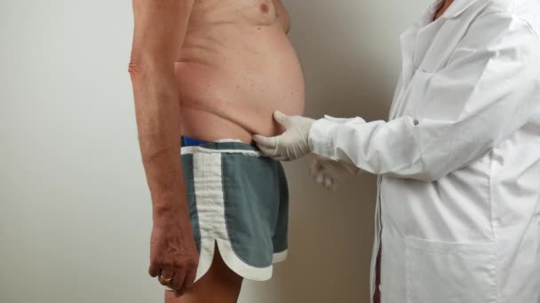 Cirujano haciendo un chequeo médico palpando el vientre en los tejidos adiposos celulitis, en un paciente con vientre flácido, visto desde el perfil lateral — Vídeos de Stock