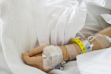 El yatakta serum fizyolojik solüsyonu ile