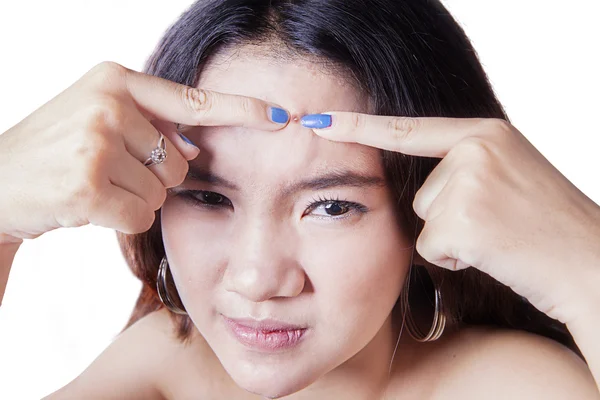 Teenage girl removing pimple — Stock Photo, Image