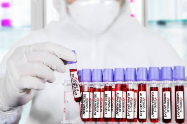 Close up of male doctor hands in protective glove holding blood sample tube of covid-19 delta variant while analyzing in the laboratory