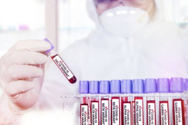 Close up of male scientist hands in protective glove holding blood sample tube of covid-19 delta variant while doing research in the laboratory