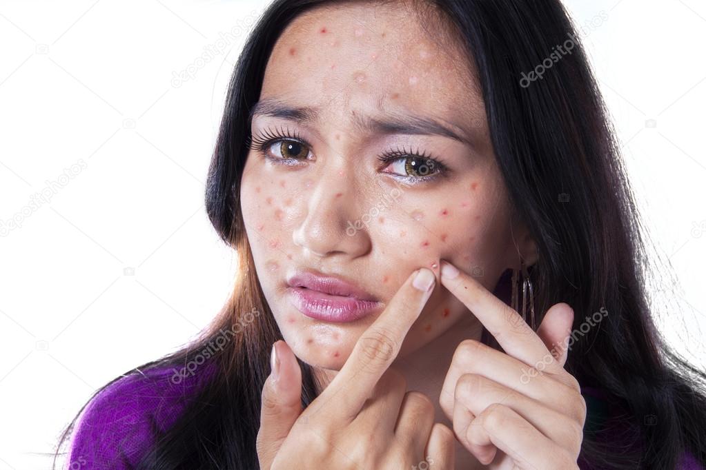 Unhappy girl touching pimple on cheek