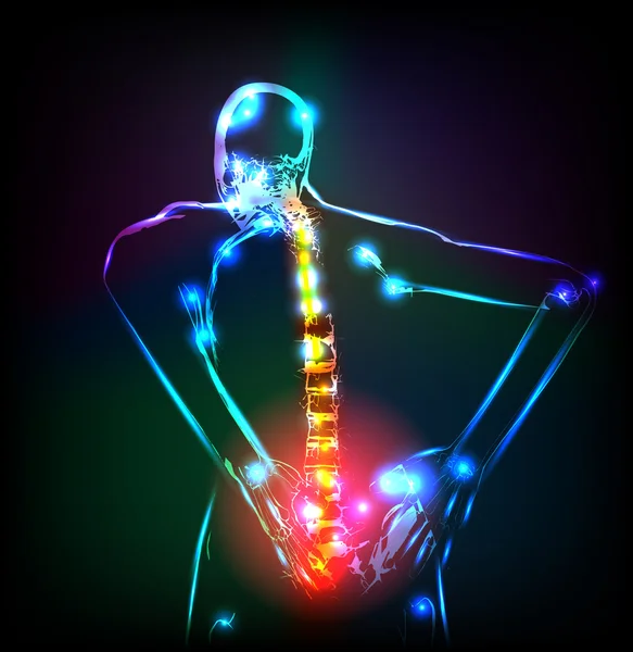 Columna vertebral humana en rayos X, dolor de espalda, fácil de editar — Vector de stock