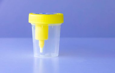 A plastic container for urine sample with a yellow lid sits on a blue table. The container is empty. Concept of medical analytics