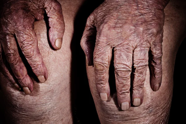 Mãos de uma velha de joelhos, detalhe — Fotografia de Stock