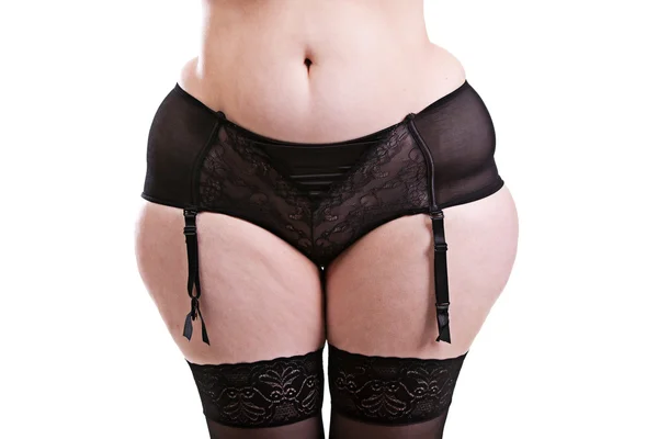 Part of the body of the girl with cellulite — Stock Photo, Image