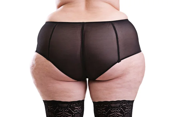 Part of the body behind the girl with cellulite — Stock Photo, Image