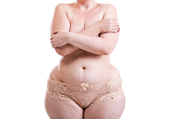 Body obese women 