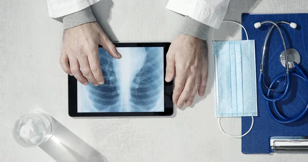 Professional Doctor Working His Desk Checking Patient Lungs Ray Image — Stock Photo, Image