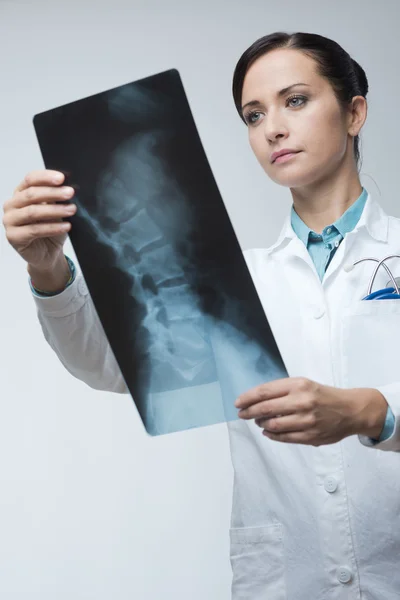 Kvinnliga läkare undersöka röntgen — Stockfoto