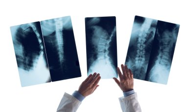 Radyolog bir x-ray görüntü denetimi