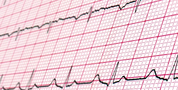 Cardiogram kutatás. Háttér — Stock Fotó