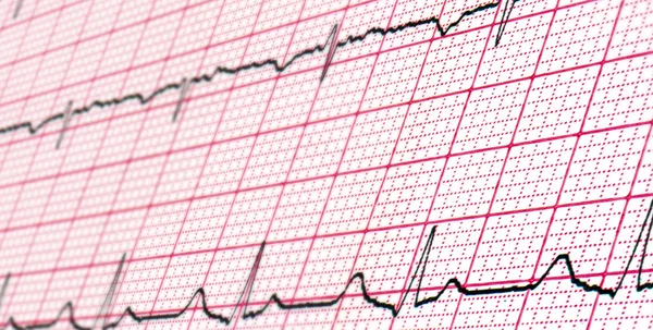 Elektrokardiogram forskning. Bakgrund — Stockfoto