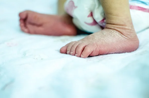 Close up de recém-nascidos pés de bebê com um hospital — Fotografia de Stock