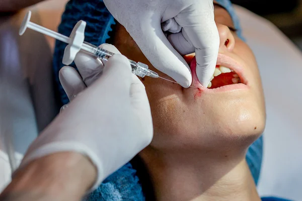 Młoda kobieta dostaje zastrzyk w jej usta w gabinecie kosmetycznym. — Zdjęcie stockowe
