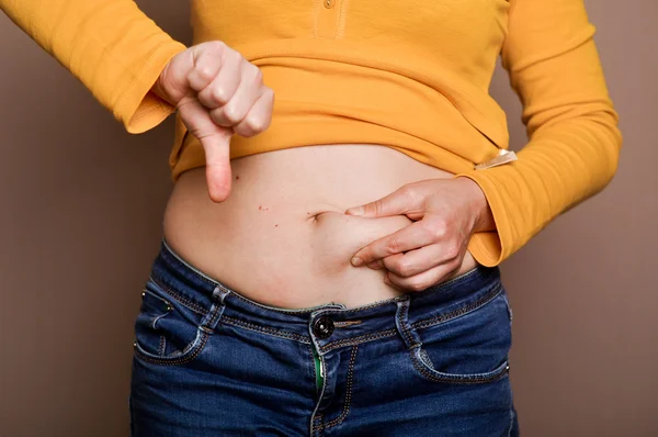 Young girl shows her obesity — Stock Photo, Image