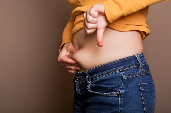 Young girl shows her obesity — Stock Photo, Image