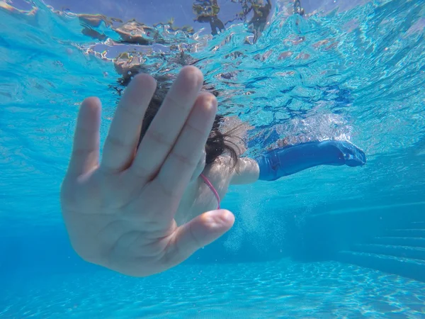 Unrecognizable girl with plastered arm swimming underwater in pool