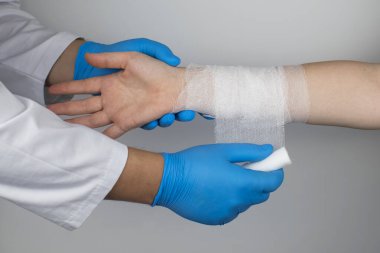 Travmatolog kadın hastanın ön koluna bir bandaj koydu. Kırıklar ve burkulmalar için yardım kavramı. Çarmıha germe bandajı tekniği.