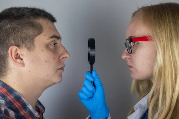 Acne Close Homem Está Ser Examinado Por Médico Dermatologista Examina — Fotografia de Stock