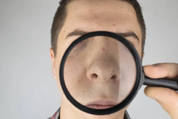 Acne close-up. A man is being examined by a doctor. Dermatologist examines the skin through a magnifier, a magnifying glass