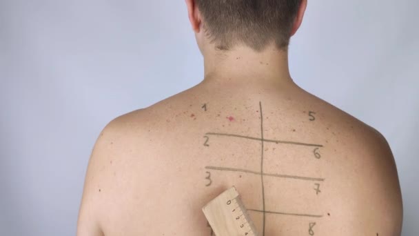 Ein Allergologe Oder Dermatologe Untersucht Rote Flecken Gesicht Des Mannes — Stockvideo